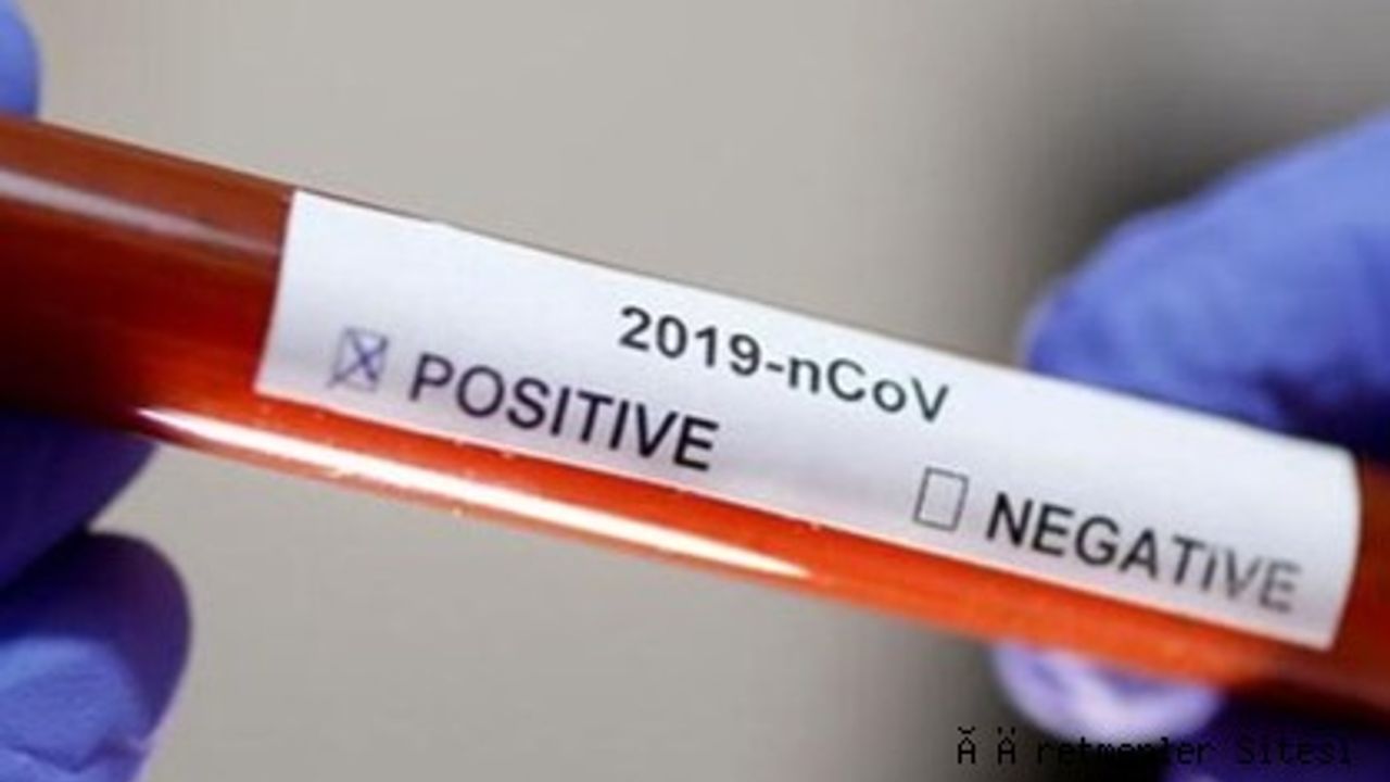 Sağlık bakanlığı 28 Ocak 2022 Koronavirüs Tablosunu Açıkladı: Vaka ve Ölü Sayısında Büyük Artış