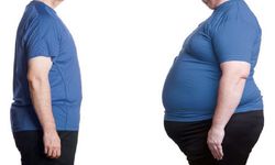 Uzmanından "obezite basit bir kilo alımı değil" uyarısı