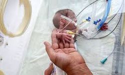 Dünyaya 430 gram gelen prematüre bebeğe kalp ameliyatı
